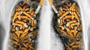 Tabaquismo un riesgo innecesario