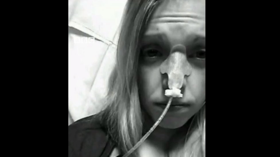 "A mi anorexia le encantaba Instagram"